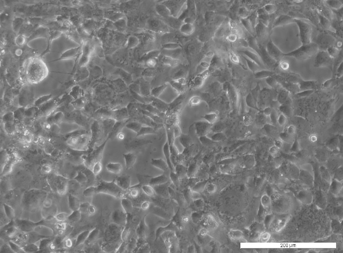 PEO16 Cell Line. Image courtesy of the European Collection of Authenticated Cell Cultures (ECACC)