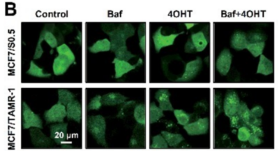 Establishment of MCF-7/TAMR-1 Cell line