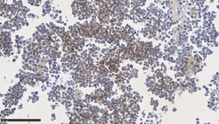 IHC staining of T cells