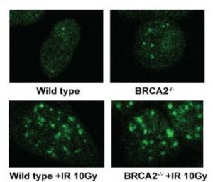 HCT 116 BRCA2 -/- 42 Cell Line. Early log phase. Image courtesy of the European Collection of Authenticated Cell Cultures (ECACC)