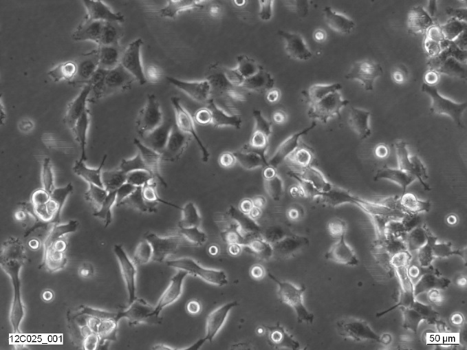 2fTGH-U2A Cell Line. 3 days post plating. Image courtesy of the European Collection of Authenticated Cell Cultures (ECACC)