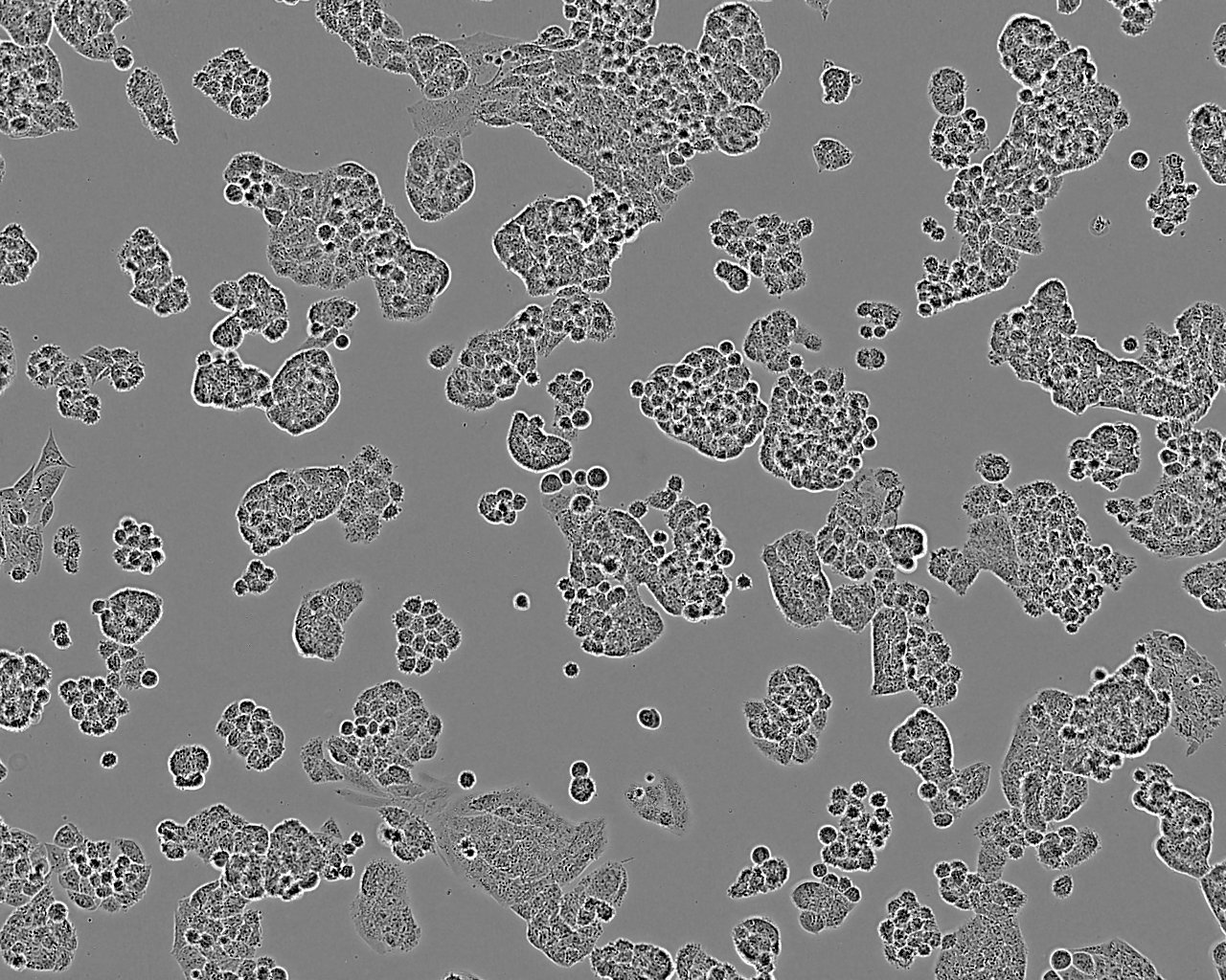 A2780 Cell Line. 48 hours post plating. Image courtesy of the European Collection of Authenticated Cell Cultures (ECACC).