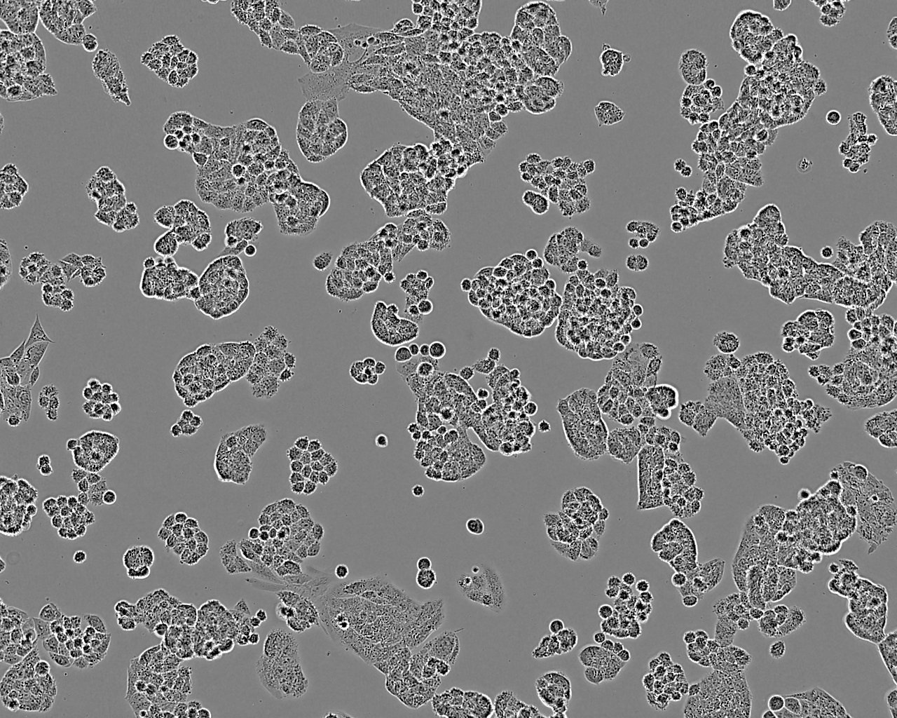 A2780 Cell Line. 48 hours post plating. Image courtesy of the European Collection of Authenticated Cell Cultures (ECACC).