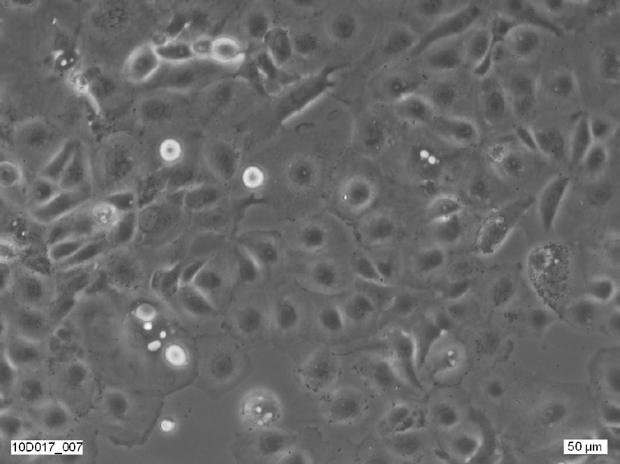 PEO14 Cell Line. Image courtesy of the European Collection of Authenticated Cell Cultures (ECACC)