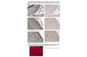 Anti-CRF (Affinity Purified, Sheep)