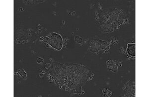 C84 Colorectal adenocarcinoma Cell Line