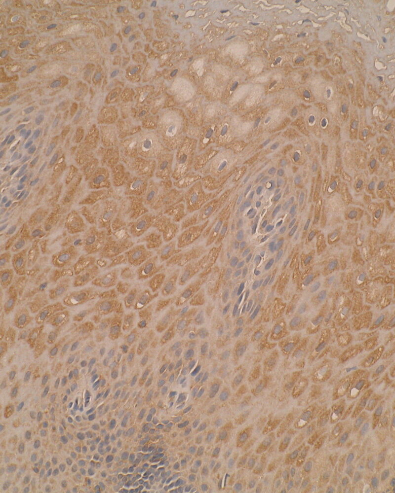 Immunohistochemistry was performed on formalin-fixed; paraffin-embedded squamous oesophagus epithelial tissue sections using anti-SBSN [Z47P1E7*F5]. Cytoplasmic staining were detected; consistent with current literature. Anti-SBSN [Z47P1E7*F5] has been shown to demonstrate great specificity in differentiating squamous cells from other types of epithelial cells.