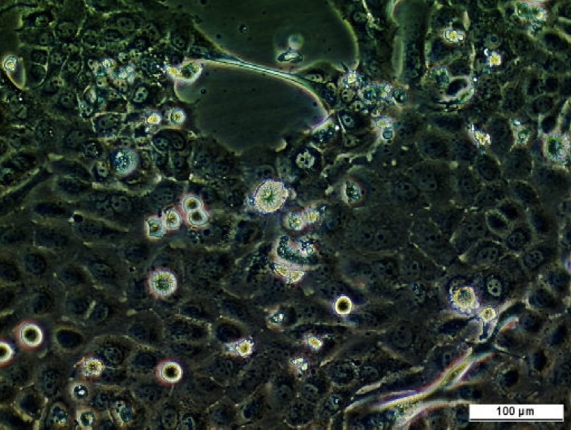 BL 30 UDS BICR. "PZ" M-3.5X16 - Unit