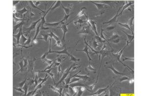 MEF ULK1/2 WT (SIM) Cell Line