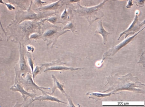 C-Raf KI D486A Cell Line. Early log phase. Image courtesy of the European Collection of Authenticated Cell Cultures (ECACC), UK.