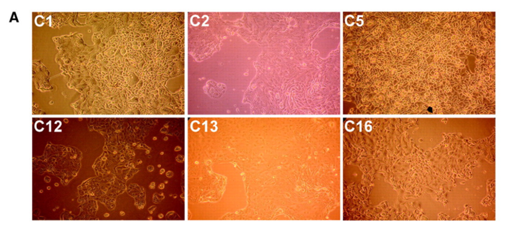 Image: Figure from Tzukerman et al., 2009 (PMID 1998034). Fig. 2. In vitro chacterisation of the different CCSP’s and detection of ovarian cancer-associated biomarkers. A, phenotypic appearance of the six isolated CCSPs.