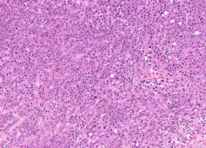 Representative example of haematoxylin and eosin staining of CRUK0640 T1-R1 TRACERx lung cancer PDX model at early P0 passage.