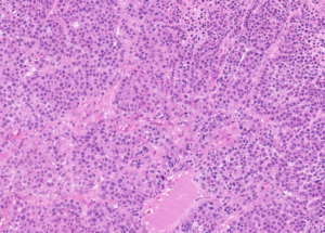 Representative example of haematoxylin and eosin staining of CRUK0640 T1-R8 TRACERx lung cancer PDX model at early P0 passage.