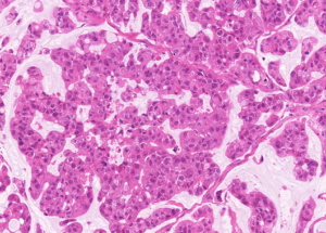 Representative example of haematoxylin and eosin staining of CRUK0748 T1-R1 TRACERx lung cancer PDX model at early P0 passage.