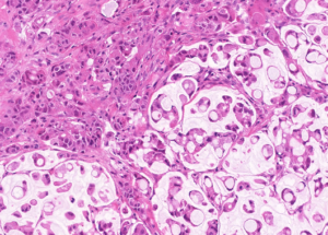 Representative example of haematoxylin and eosin staining of CRUK0748 T1-R2 TRACERx lung cancer PDX model at early P0 passage.
