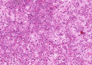 Representative example of haematoxylin and eosin staining of CRUK0748 T1-R6 TRACERx lung cancer PDX model at early P0 passage.