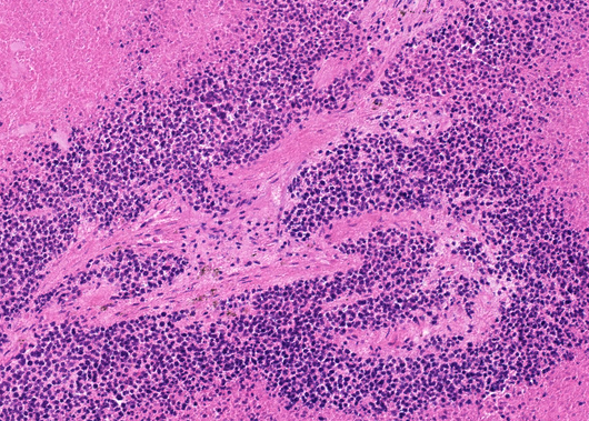 Representative example of haematoxylin and eosin staining of CRUK0935 T1-R5 TRACERx lung cancer PDX model at early P0 passage.