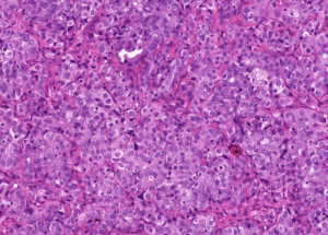 Representative example of haematoxylin and eosin staining of CRUK0995 T1-R3 TRACERx lung cancer PDX model at early P0 passage.