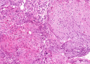 Representative example of haematoxylin and eosin staining of CRUK1054 T1-R4 TRACERx lung cancer PDX model at early P0 passage.