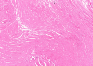 Representative example of haematoxylin and eosin staining of CRUK1061 T1-R5 TRACERx lung cancer PDX model at early P0 passage.