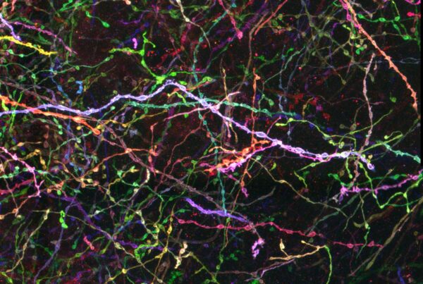 Parvalbumin expressing neurons labelled by AAV-Brainbow and stained with Brainbow 3 XFP antibodies against mTFP, mCherry, TagRFP, and EGFP. Image credit: Dawen Cai