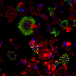 Image: Fluorescent staining of dendritic cells