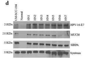 Detection of HPV-16-E7 expression. Adapted from Kannan et al. 2017.