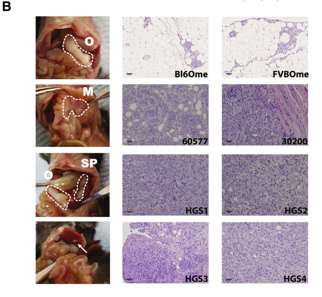 Image: H&E-stained tissue sections derived from mouse model tumours (HGS) (scale bars – 100 μm). Reference – Mainati et al. Cell Reports. Vol 30 (2), 2020