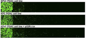 Mutant p53 enhances invasion in pancreatic cancer cells. An inverted-invasion assay comparing KPC cell lines shows that cells carrying the p53R172H mutation invade much more deeply into the matrix than cells with wild-type p53. Introducing mutant p53 into wild-type cells restores this highly invasive behaviour, demonstrating that mutant p53 actively drives tumour cell invasion. Image taken from Morton JP et al.