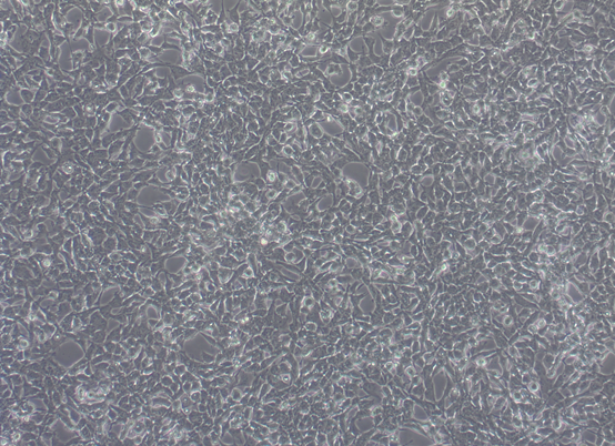 Meningioma grade III NCH93 cell line