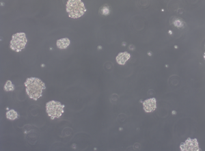Glioblastoma WHO IV spheroid cell line
