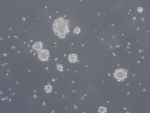 Glioblastoma WHO IV spheroid cell line