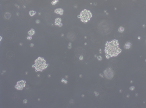 Glioblastoma WHO IV spheroid cell line