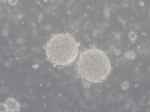 IDHmut glioma stem-like NCH551b cell line