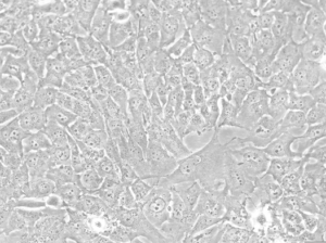 Glioblastoma WHO IV NCH89 cell line