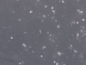 Glioblastoma WHO IV NCH156 cell line