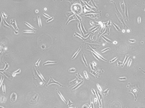 Glioblastoma WHO IV NCH149 cell line