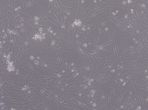 Glioblastoma WHO IV NCH342 cell line