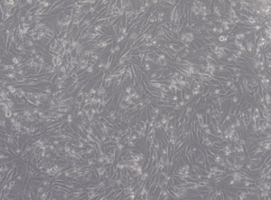 Glioblastoma WHO IV NCH270 cell line