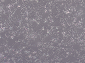 Glioblastoma WHO IV NCH417 cell line