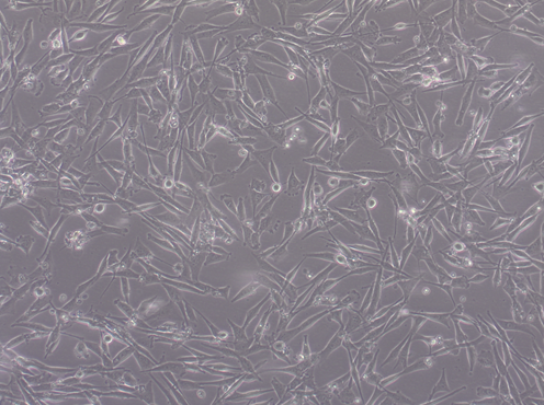 Glioblastoma WHO IV NCH417 cell line