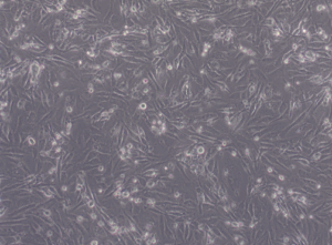 Glioblastoma WHO IV NCH354 cell line