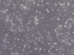 Glioblastoma WHO IV NCH676 cell line