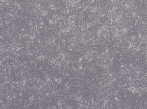 Glioblastoma WHO IV NCH474 cell line