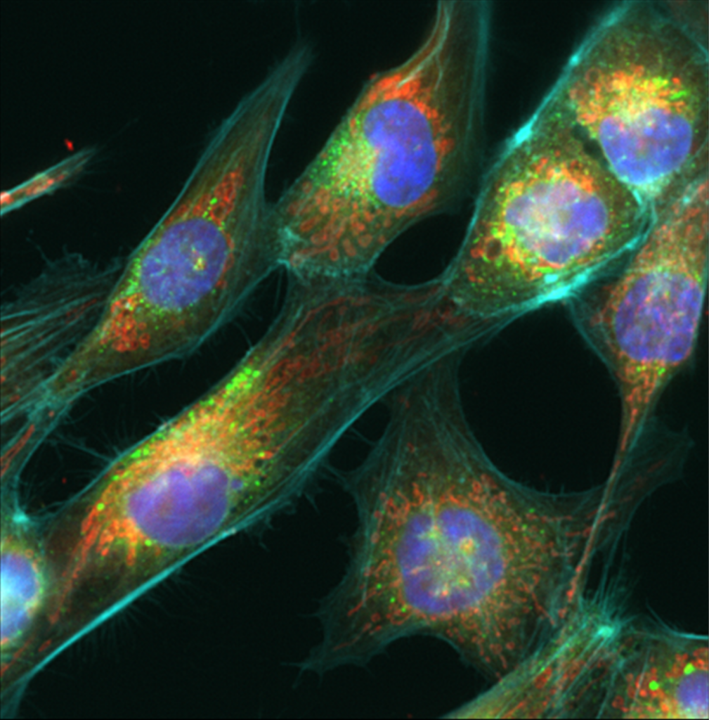 GBM Stem cell line labelled using Cell Painting technique described in Elliott 2026.
