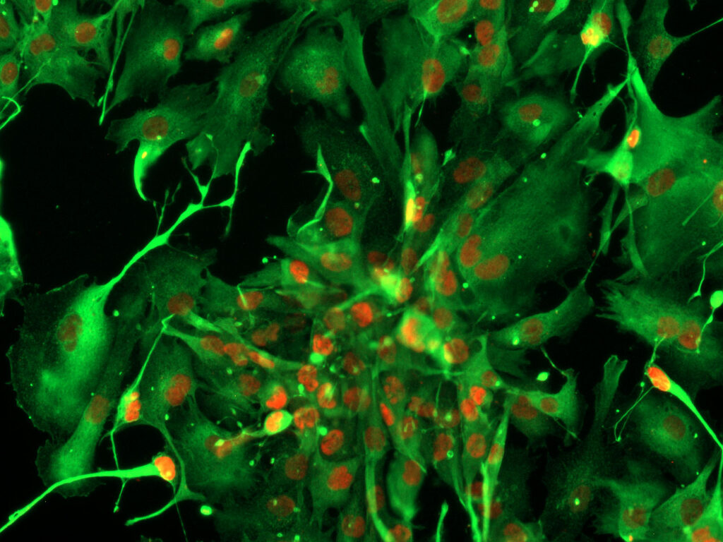 GCGR E20 Cell line