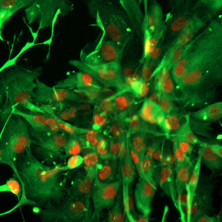 GCGR-E20. Courtesy of Pollard Lab, University of Edinburgh. SOX2 (red), NESTIN (green)