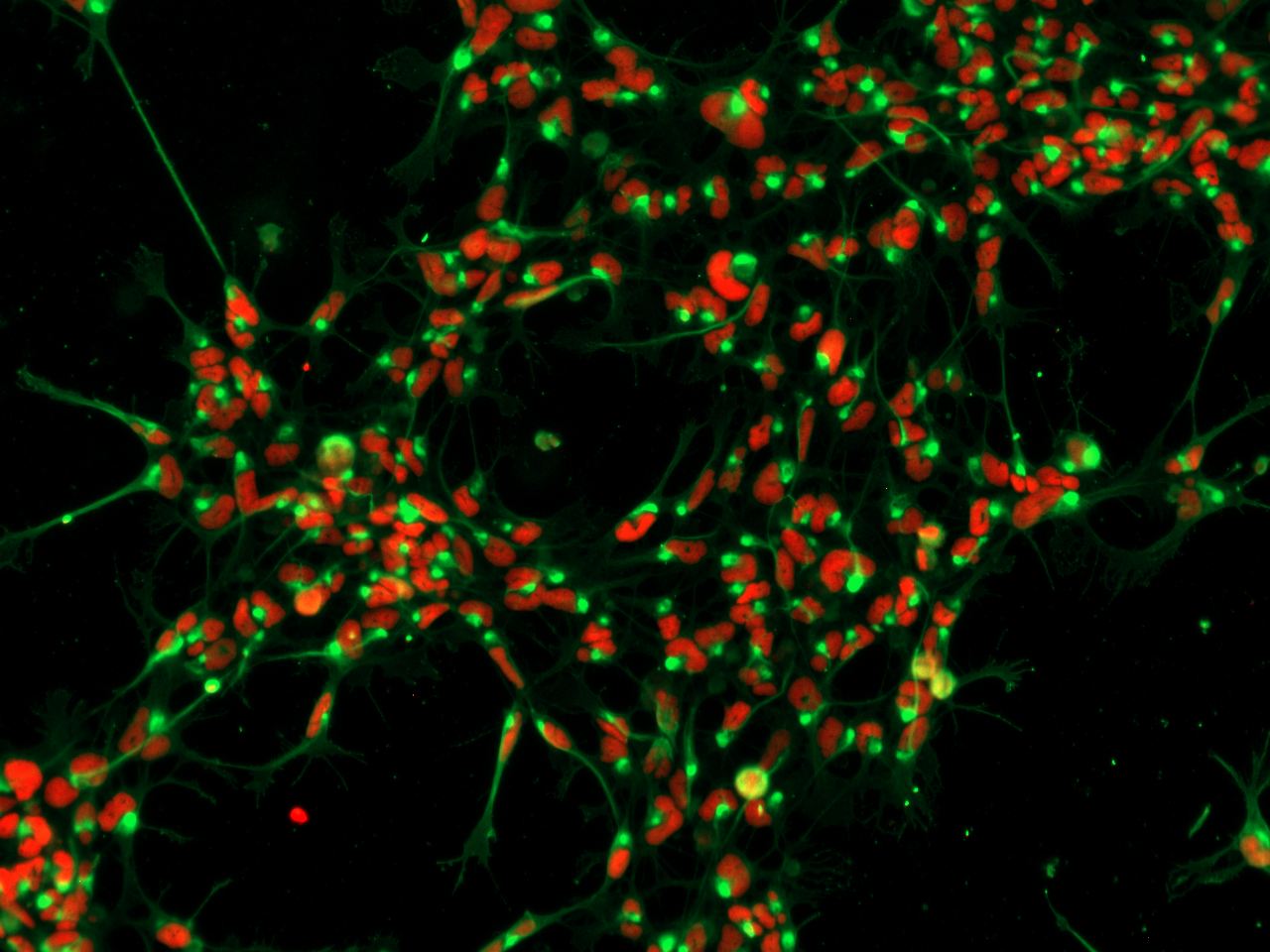 ICC image of glioma cell lines