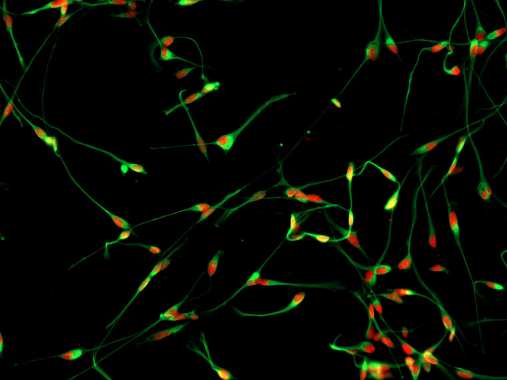GCGR E63 Cell line