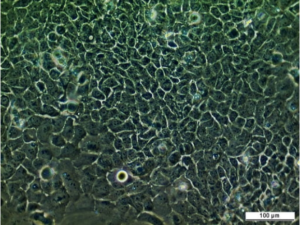 H357 Cell Line